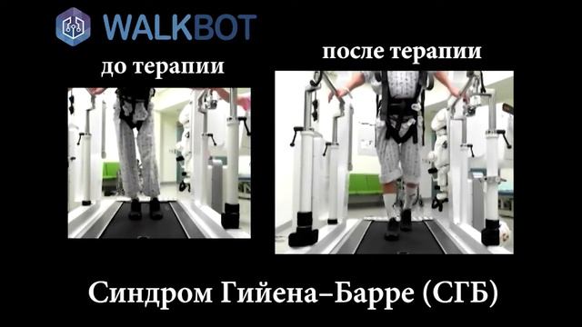 Кейс 3 Синдром Гийена–Барре СГБ смотреть онлайн