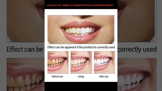 Как очистить зубы от желтого и черного налета в домашних условиях? смотреть онлайн