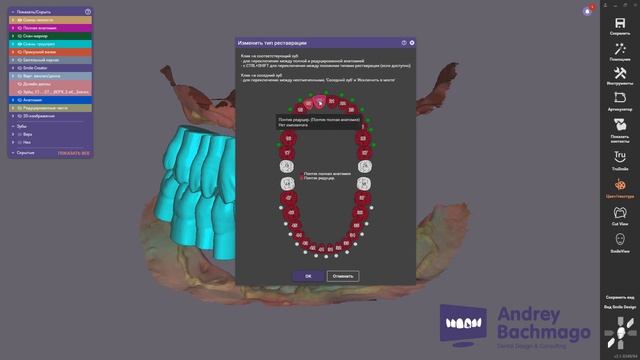 понедельничный Exo-лайфхак №6 - горячие клавиши в #exocad