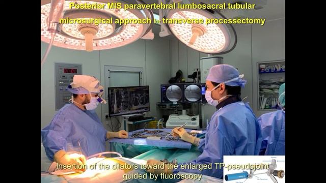 Bertolotti Syndrome: Initial Management And Main Surgical Strategies