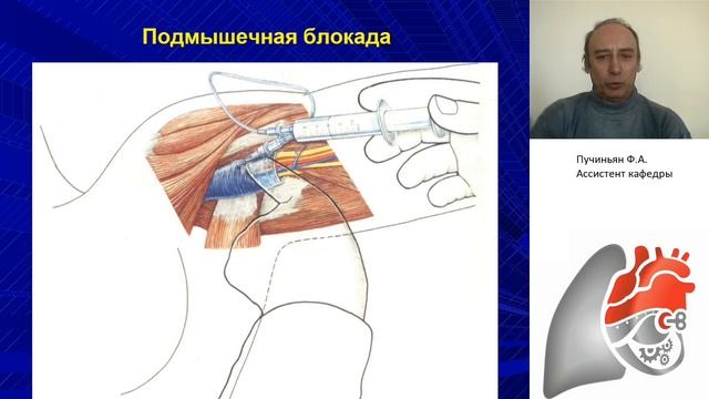 Понятие о региональной и сочетанной анестезии. Местные анестетики. Пучиньян Ф.А.