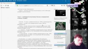 Аудио-статья: Ти-Радс на основе рекомендаций Американского Колледжа Радиологии (ACR)