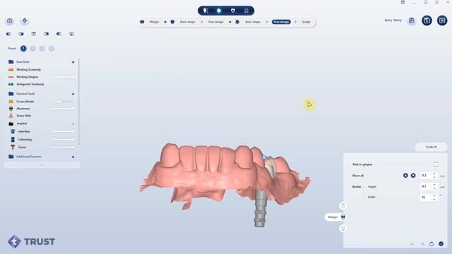 FREE ABUTMENT SOFTWARE смотреть онлайн