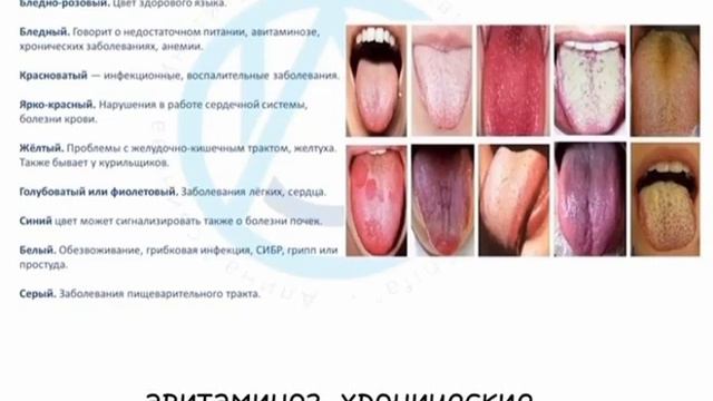 ЯЗЫК - ЗЕРКАЛО ВНУТРЕННЕГО СОСТОЯНИЯ OРГАНИЗМА 🔥 смотреть онлайн