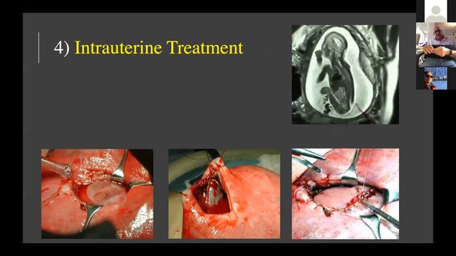 Clash of the Titans: In ped. neurosurgery prenatal radiological investigations do not serve any use смотреть онлайн