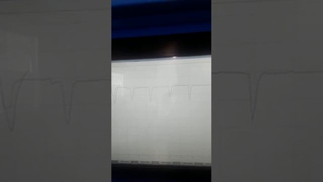 Экспресс-ремонт: быстро и качественно