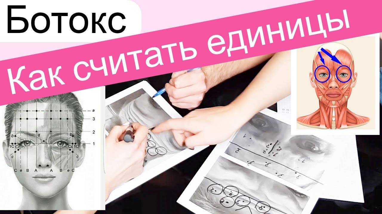 Как считать единицы по зонам : Ботокс, Ботулакс, Диспорт смотреть онлайн