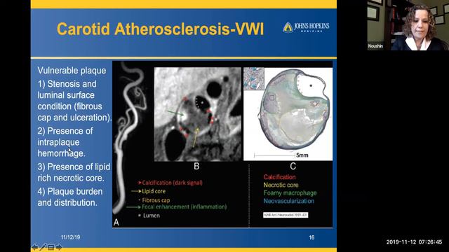 Non Invasive Neurovascular Imaging - Complete Lecture | Health4TheWorld Academy смотреть онлайн