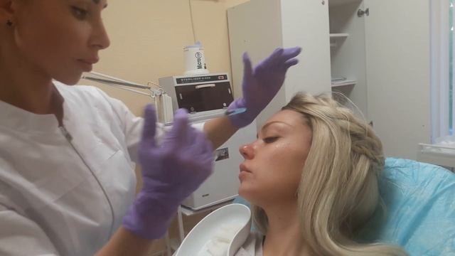 АирисКом студенты учатся: практика. Мезоботокс скуловой области.