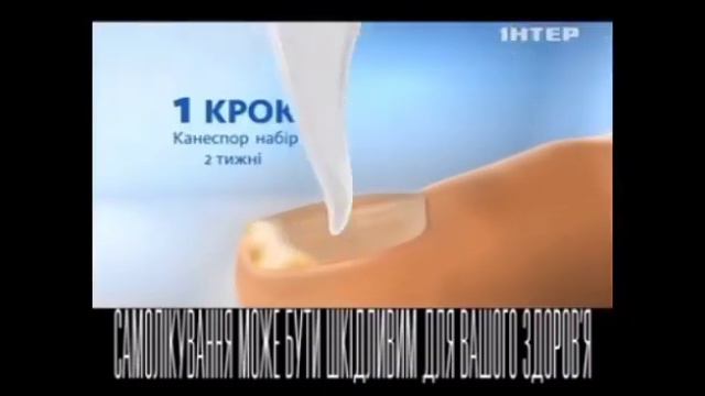 Канеспор - два шага к здоровым ногтям. смотреть онлайн