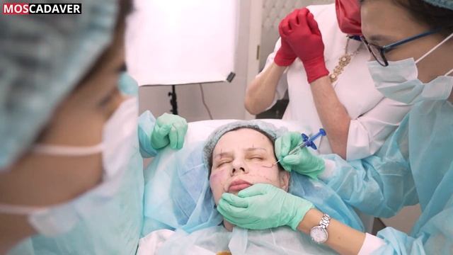 Кадавер курс для врачей косметологов под руководством Л.Ю. Колесовой