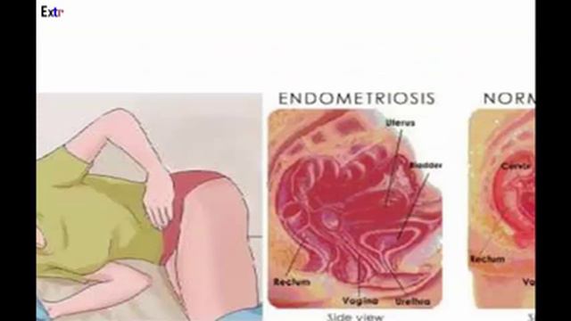 This Powerful Combination Can Cure Most Diseases – Acts Instantly Against Colds & Flu смотреть онлайн