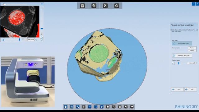 Shining 3D Autoscan DS-EX scanner dynamic bite occlusion transfer workflow смотреть онлайн