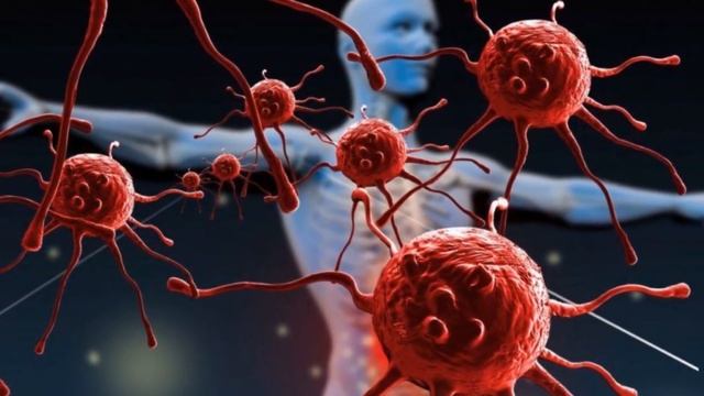 Мочевая кислота, Подагра, Камни в Почках! 6 продуктов для Растворения Кристаллов Мочевой Кислоты смотреть онлайн