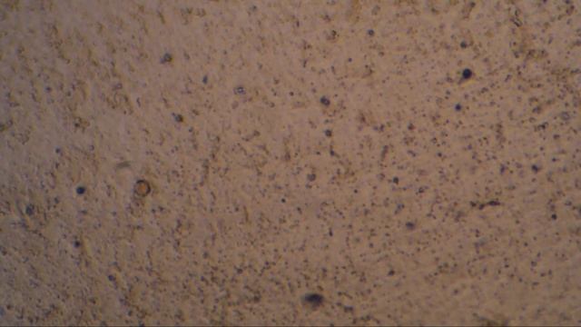 Seilwurm плюс отвар соцветий черной бузины 144 смотреть онлайн