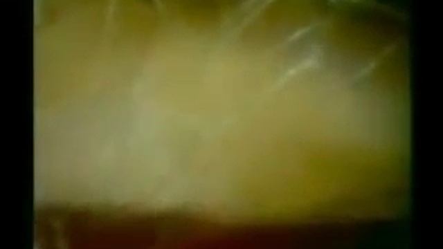 Соединительная ткань. смотреть онлайн