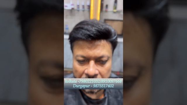 Hairline Patch for Receding Hairline | #hair #hairreplacement #hairissues #hairwig #kolkata#durgapu смотреть онлайн