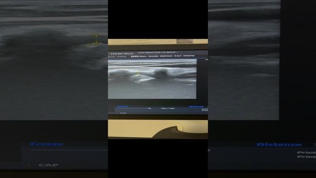 Искривление позвоночника. Узи сосудов шеи и головы. Флеболог. Флеболог Москва смотреть онлайн