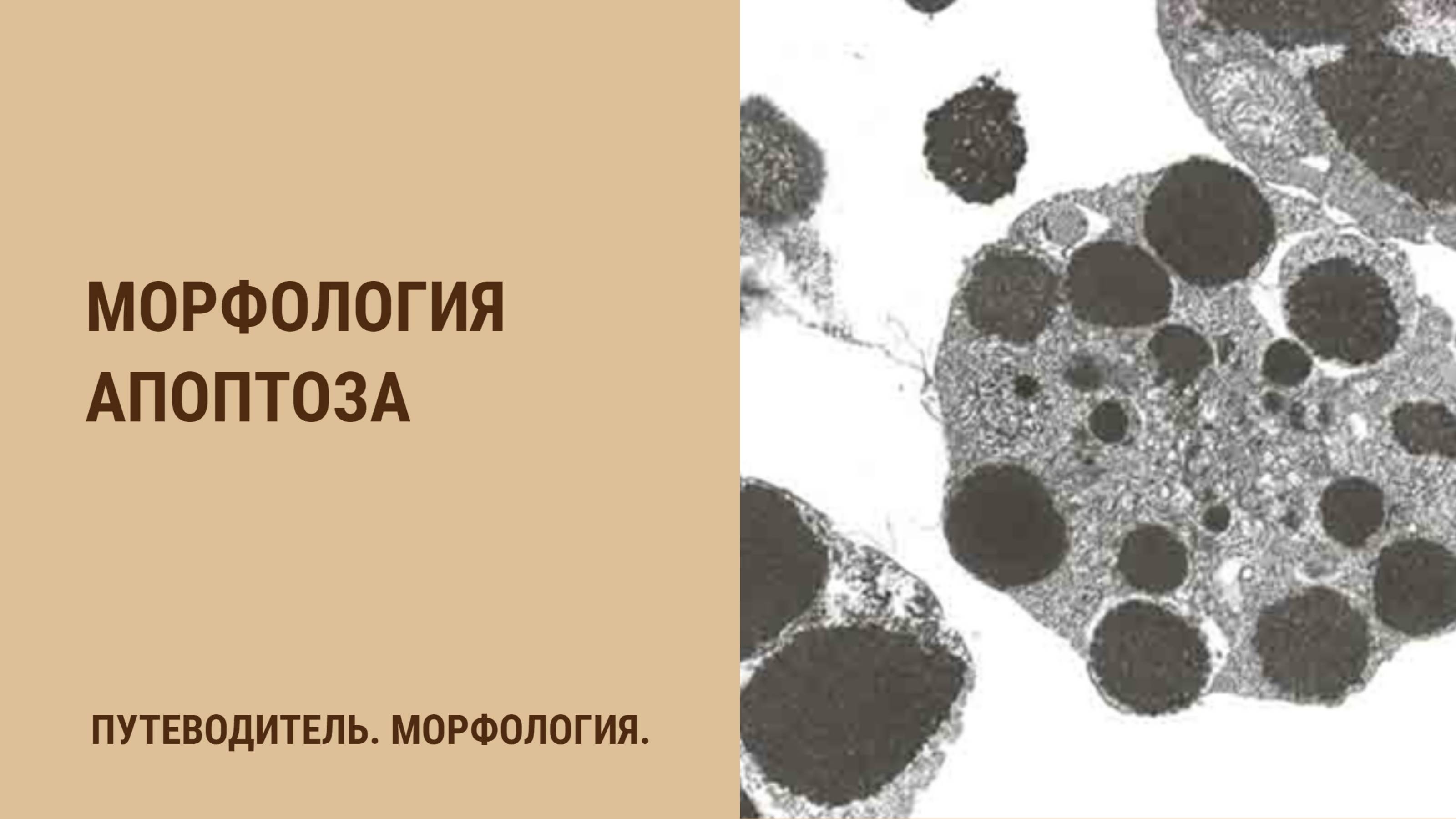 Морфология апоптоза смотреть онлайн