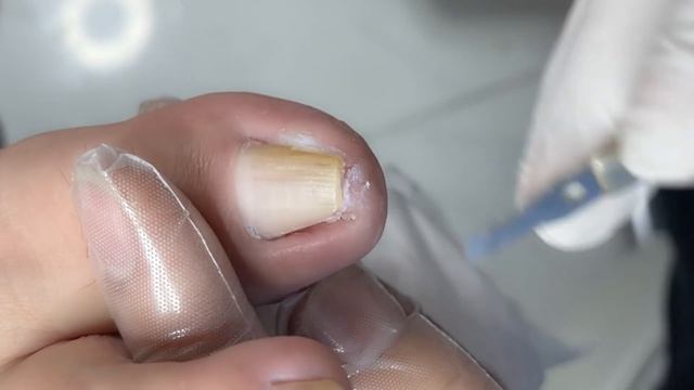 Pedicure Tutorial: Super Curved Nail Treatment