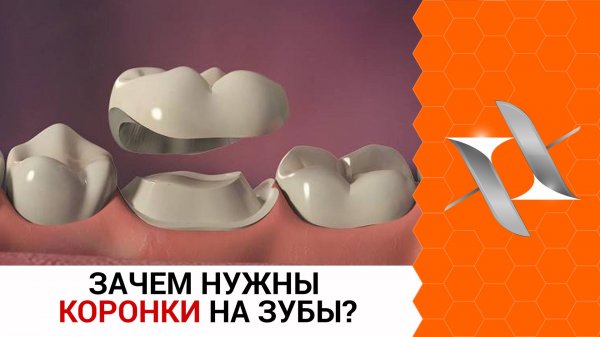 Зачем нужны коронки на зубы