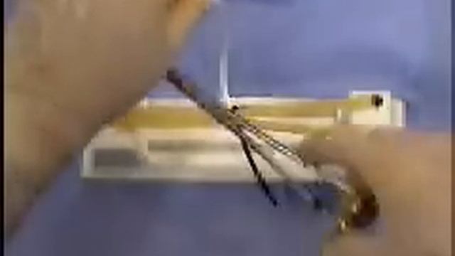 Хирургический узел 12 смотреть онлайн