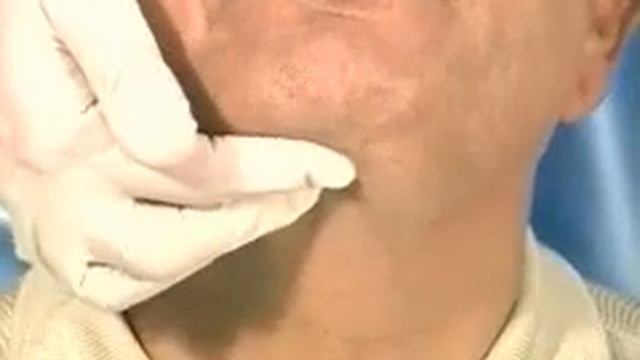 Diagnosis & Examination of the submental lymphnodes (Dentistry) смотреть онлайн