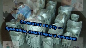 Стоматит во рту — причины, симптомы и лечение