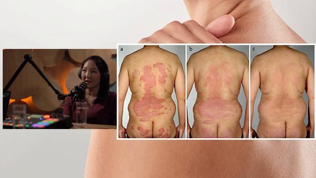 Хайрст үлд эдгэрдэг өвчин үү? АУ-ны доктор, дэд профессор Ц. Сарангуа эмчтэй ярилцлаv смотреть онлайн