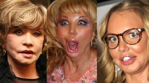 Неудачные пластические операции российских звёзд