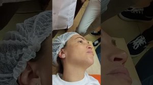 DMAE LIFT ELDERMAFILL. Канюльная техника. Лектор: Чуприна Кристина