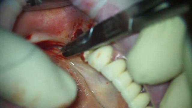 Удаление смотреть онлайн