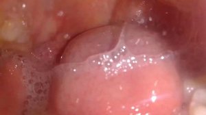 Saliva ~