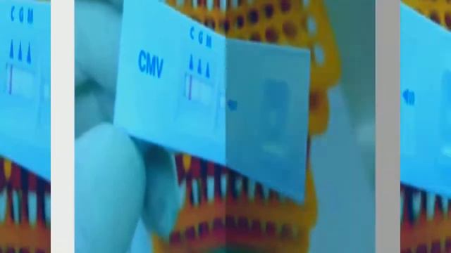 قراءة تحليل فيروس الحمل CMV | لازم كل حامل عمل تحليل فيروس الحمل IgM و IgG