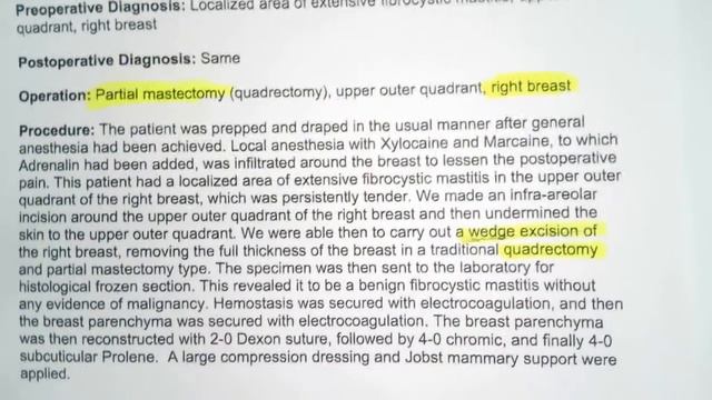 ICD 10 PCS Dissecting an Operative Report #2 смотреть онлайн