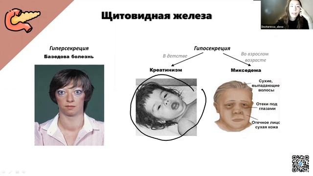 Щитовидная железа, нарушение секреции | БИОЛОГИЯ ОГЭ 2023