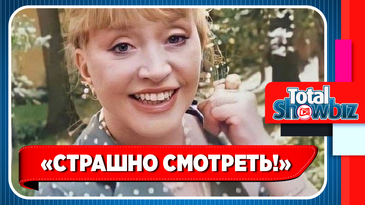 Алла Пугачева покрылась старческой плешью