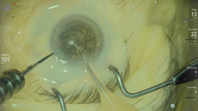 Anton Angelov Vista Live Stream смотреть онлайн