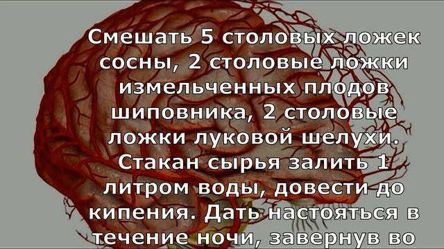 Чистим сосуды головного мозга - лучшие рецепты смотреть онлайн