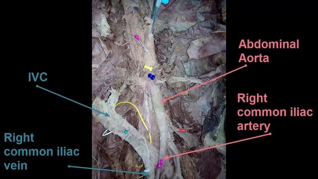 Module 17 - GIT - Practical Anatomy - Mariam Mamdouh - Soft Tissue смотреть онлайн
