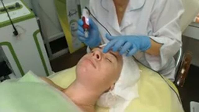 Пилинги и Дермапен для проблемной кожи. смотреть онлайн