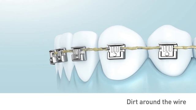 Panasonic Oral Irrigators for easy oral care even while wearing dental braces смотреть онлайн