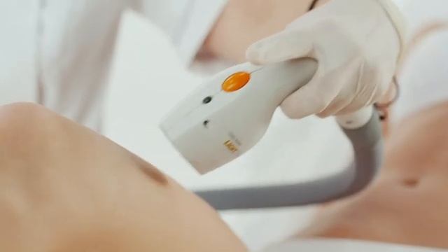 Лазерная эпиляция в Дольче вита! смотреть онлайн