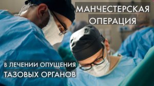 Манчестерская операция в лечении опущения тазовых органов