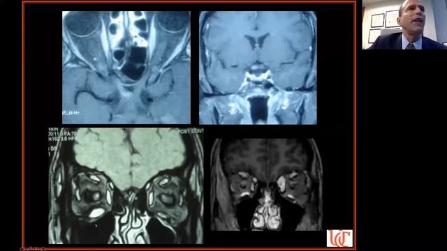 Neuroimaging in Ophthalmology смотреть онлайн