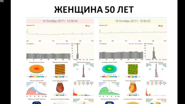 Показатели на "Лотос" здорового человека до и после прослушивания программы МЕЦ смотреть онлайн