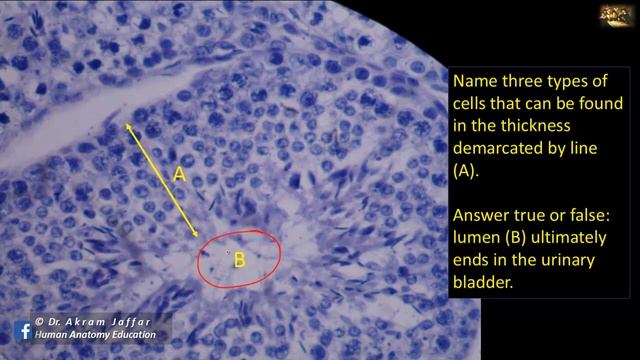 Picture tests in histology reproductive system - male смотреть онлайн