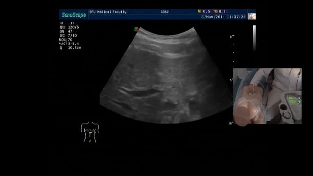 Ультразвуковая анатомия сосудов брюшной полости New