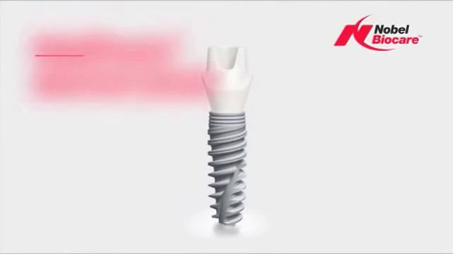 Зубные имплантаты Nobel Biocare, рекламный ролик YouTube смотреть онлайн