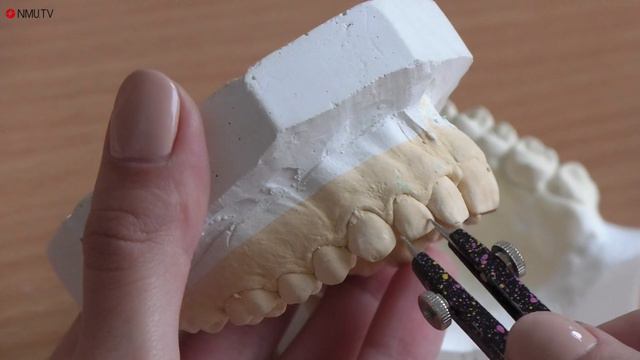 Ортодонтія: моделі смотреть онлайн